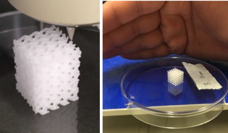 Dプリンティングによる乳房再建