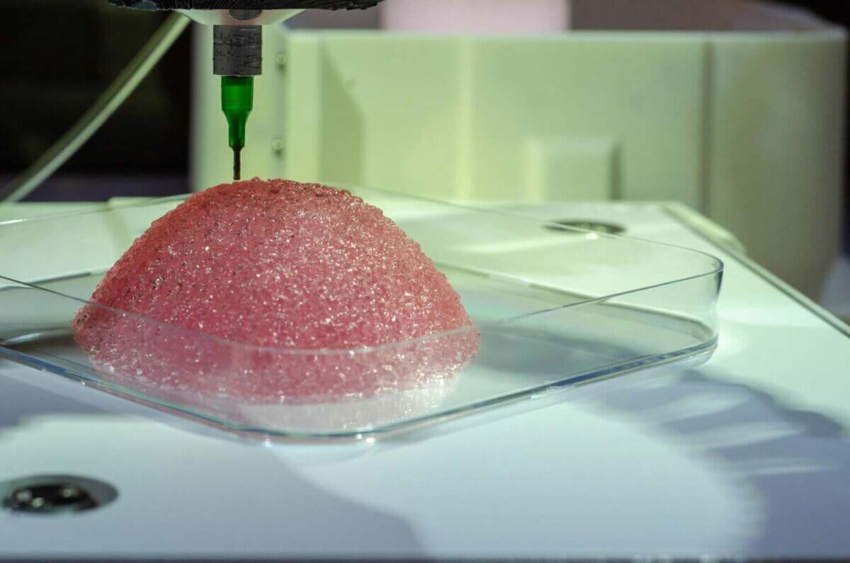 バイオ3Dプリンティングにより形成された乳房インプラント用組織　出典：Healshape社
