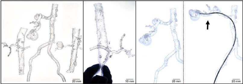 透明柔軟な光硬化樹脂を用いて3Dプリンターから作製した生体血管に近い血管模型(左・中央)と、この模型を用いたカテーテル治療の医学的手技シミュレーションの様子(右)(出典:北海道大学病院)