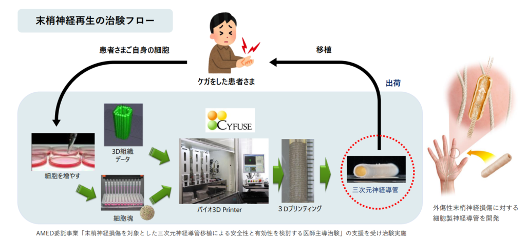 京都大学医学部付属病院における、末梢神経再生の医師主導実験の概要:出典/京都大学医学部付属病院