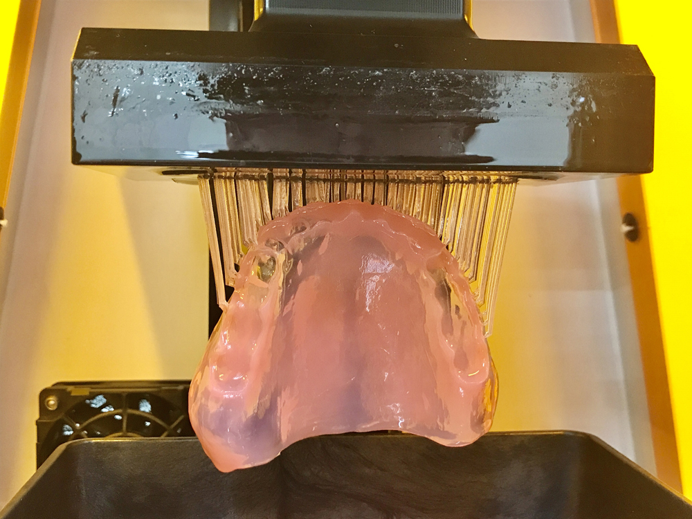 3Dプリンターで「ヨビーバ」を製作するようす/出典:日立ユニオンデンタル社