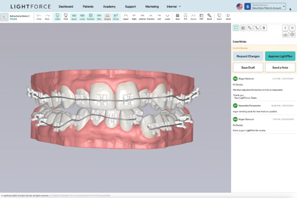 LightForce Orthodontics社のサイト