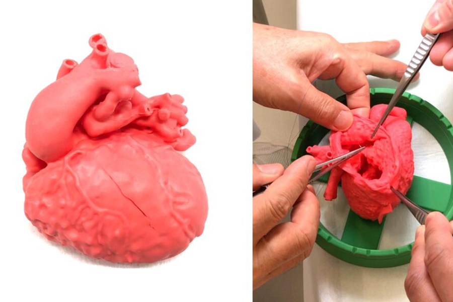 医療機器承認（クラスⅡ） を取得した「軟質実物大3D心臓モデル」