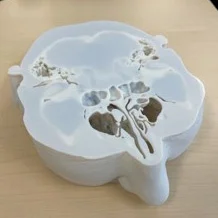 頭頸部領域の3D造形モデル